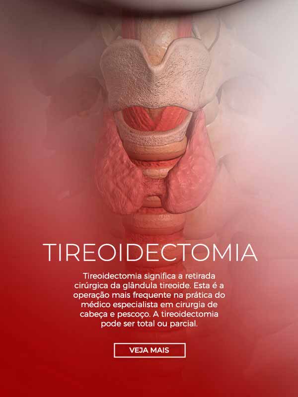 Tireoidectómica  Mobile | Dr. André Potenza